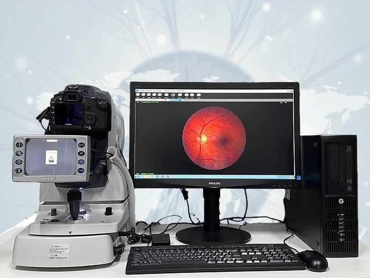 Refurbished Nidek AFC-210