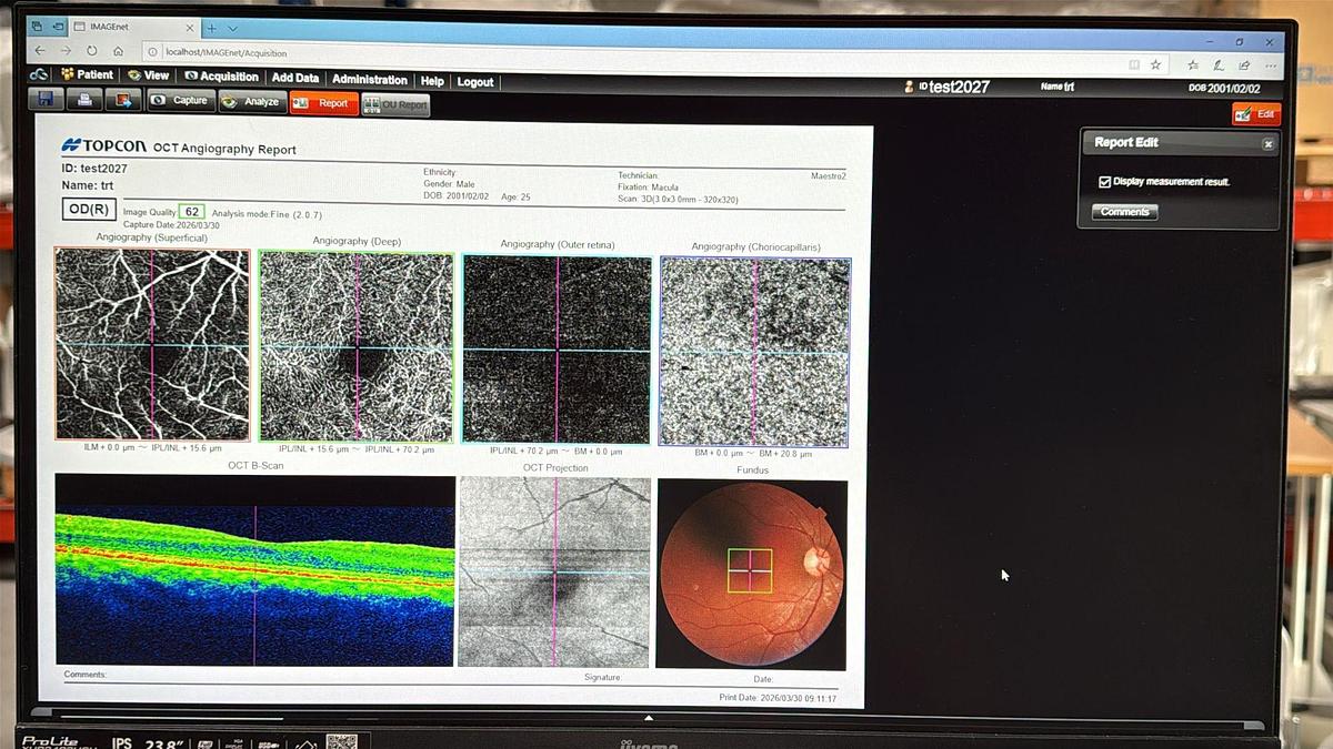 2024 Topcon 3D OCT Maestro 2