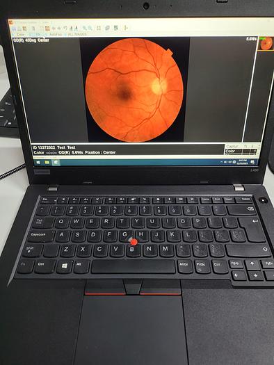 Refurbished 2011 Topcon 3D OCT-2000 FAplus