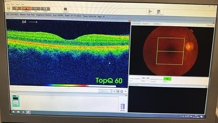 Refurbished Topcon 3D OCT-1000