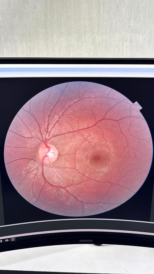 Refurbished 2015 Topcon TRC NW-400