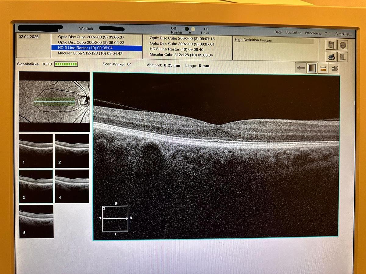 Refurbished 2014 ZEISS Cirrus 500