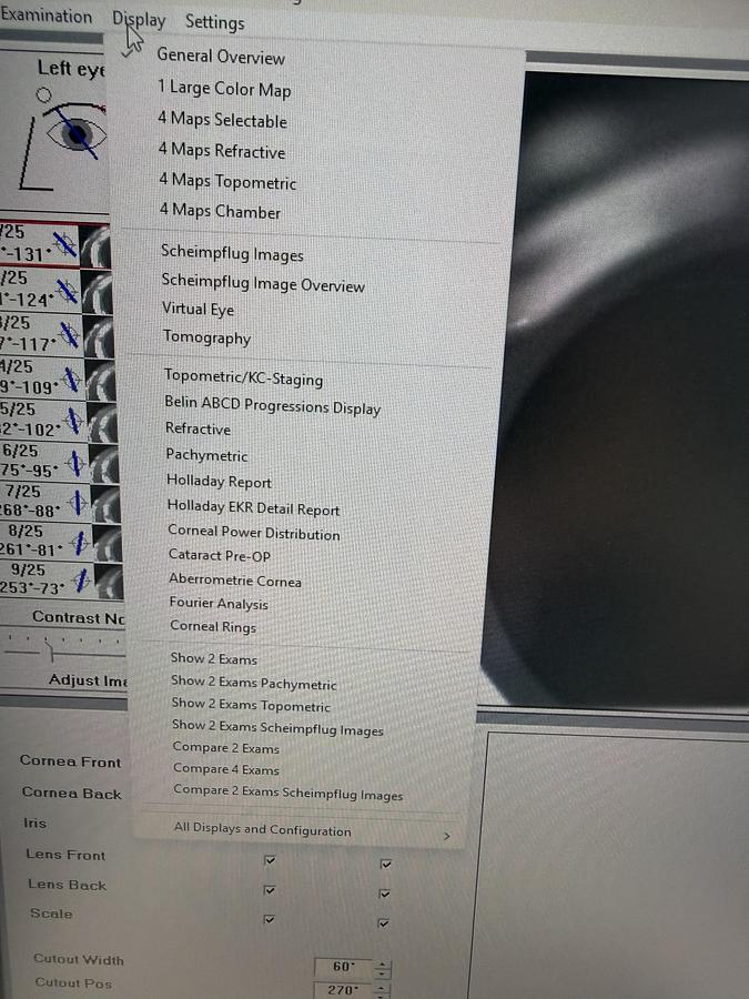 Refurbished 2014 Oculus Pentacam