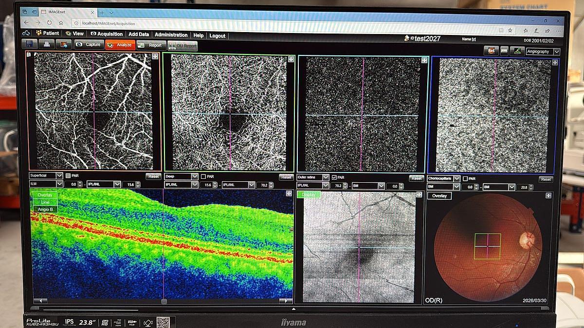 2026 Topcon 3D OCT Maestro 2
