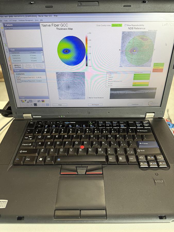 Refurbished 2013 Optovue Ivue 100-2