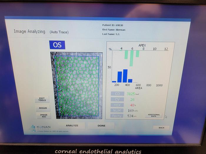 Used Conan CellChek XL NSP-9900