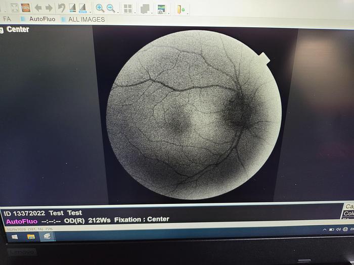 Refurbished 2011 Topcon 3D OCT-2000 FAplus