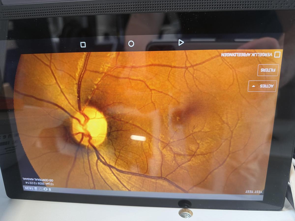Refurbished 2018 Visionix NextSight