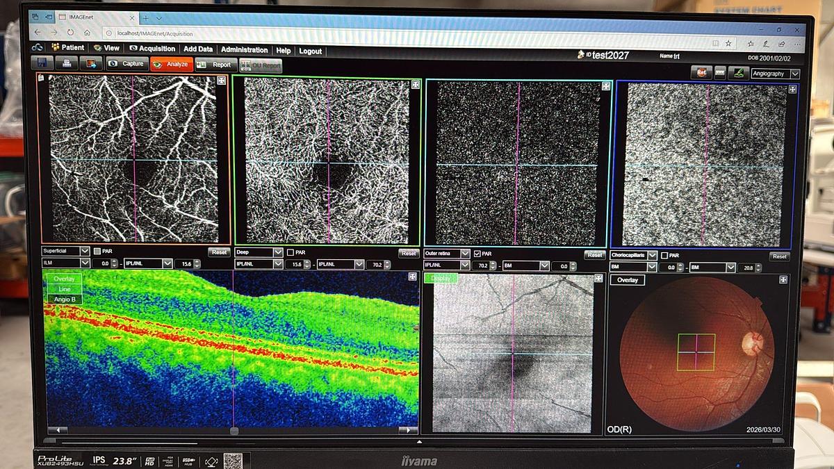 2024 Topcon 3D OCT Maestro 2