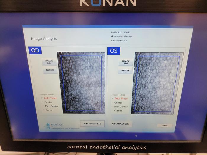 Used Conan CellChek XL NSP-9900