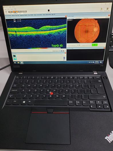 Refurbished 2011 Topcon 3D OCT-2000 FAplus