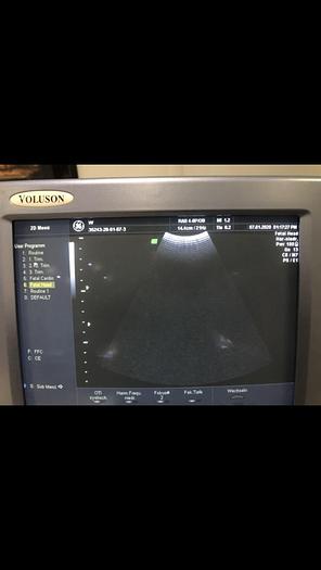 D'occasion GE Voluson 730 Pro V Ultraschallsystem mit 3 Sonden, Sony Printer