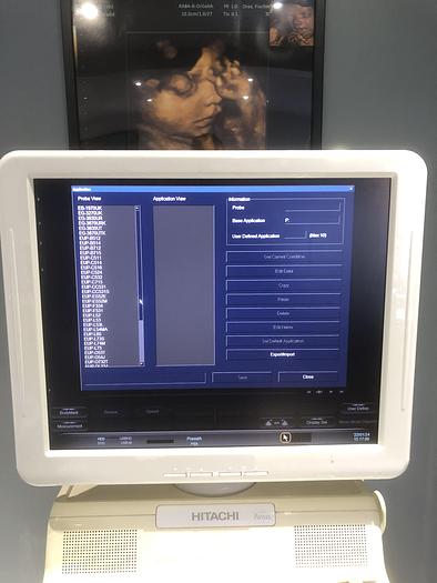 Gebraucht Hitachi-Avius-Ultraschallgerät-2007