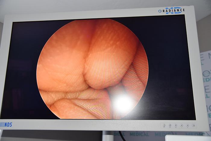 Used NDS 32" Endoscopy HD LCD Medical Monitor Radiance Flat Panel SC-WX32-A1511