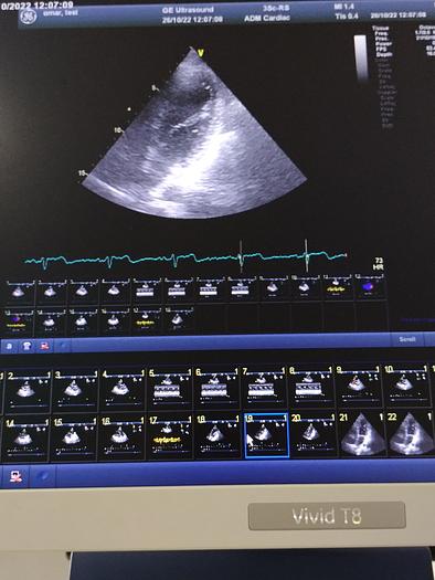 Gebraucht GE Vivid T8