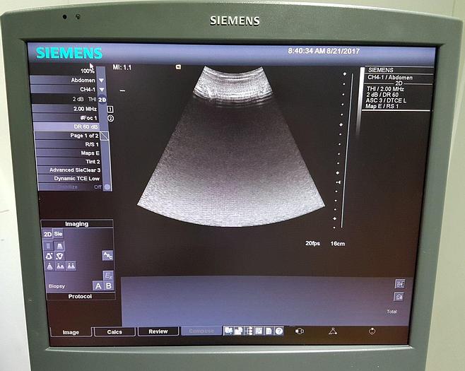 Gebraucht Siemens Acuson Antares Premium Edition 10032746 Ultraschallgerät Flachbildmonitor 5 Sonden Drucker