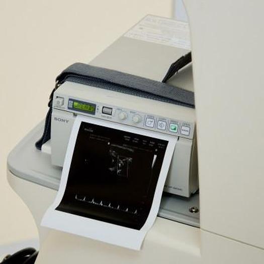 D'occasion ECHOGRAPHE  "RADIO+CARDIO"  MEDISON SONOACE X8 COULEUR DOPPLER 4 SONDES