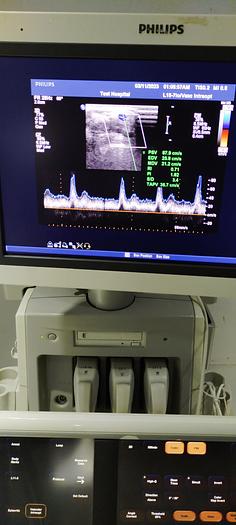 Gebraucht Philips L15-7io Sonde