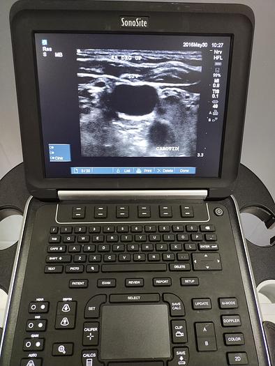 Gebraucht Sonosite Edge Ultraschallgerät inkl. 2 Sonden und Sony UP-D897 Drucker