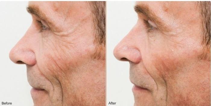 Coolifting – Beauty Gun