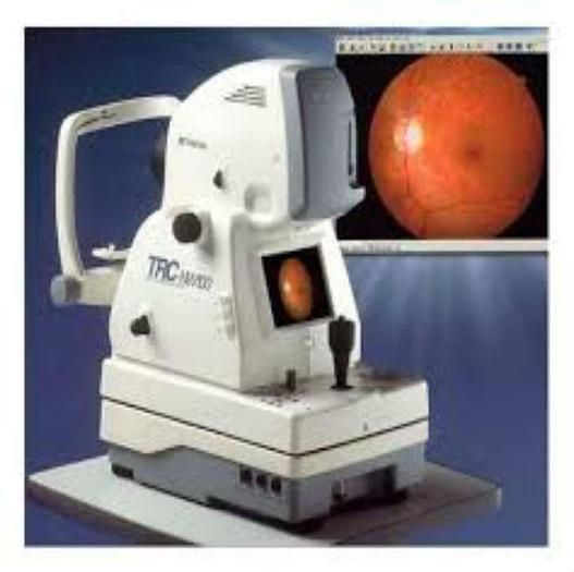 Refurbished Topcon NW 100 Fundus Camera