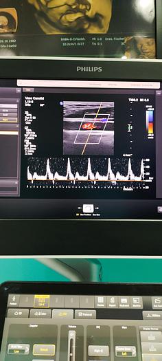 Gebraucht L18-5 Breitband-Linear-Schallkopf