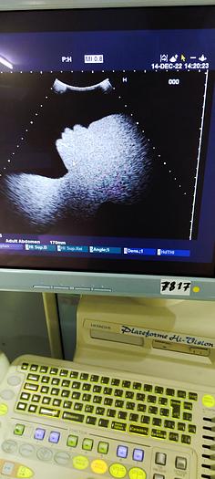 Gebraucht Hitachi 5-2 konvex Ultraschallsonde