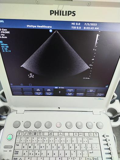 Gebraucht Philips CX50 tragbare Ultraschallgerät auf Philips CX Wagen