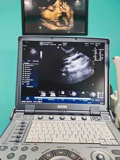 Gebraucht GE LOGIQ e tragbare Ultraschallgerät inkl. 2 Sonden und Mitsubishi P93 Drucker