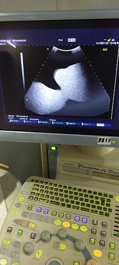 Gebraucht Hitachi 5- konvex Ultraschallsonde