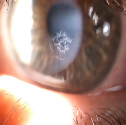 Used NEW S4Optiks Slit Lamp Camera Upgrade