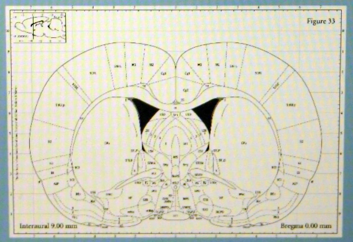 RWD AUTOMATED MOTORIZED STEREOTAXIC INSTRUMENT, MODEL 71001-S, INJECTOR & LAPTOP