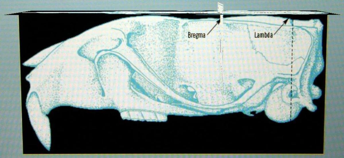 RWD AUTOMATED MOTORIZED STEREOTAXIC INSTRUMENT, MODEL 71001-S, INJECTOR & LAPTOP