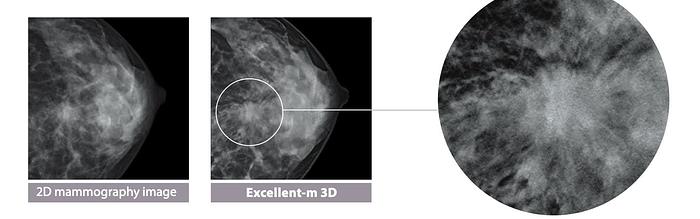 2022 FujiFilm FDR Amulet Innovality 3D