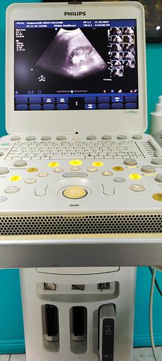 Gebraucht Philips CX50 tragbare Ultraschallgerät auf Philips CX Wagen inkl. Netzteil