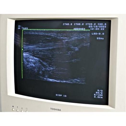 Used ECHOCARDIOGRAPHE TOSHIBA POWERVISION 6000 AVEC 3 SONDES