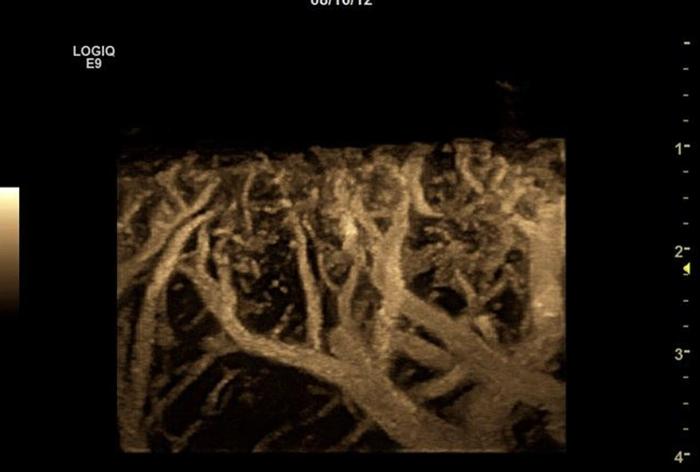 Used 2015 General Electric (GE) Logiq E9