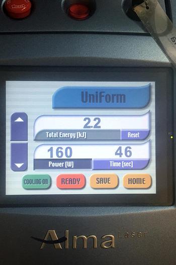 Used Alma Accent XL w/ 3 HP's: Unilarge, Bipolar & Uniform