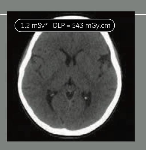 Used 2018 General Electric (GE) Optima CT660