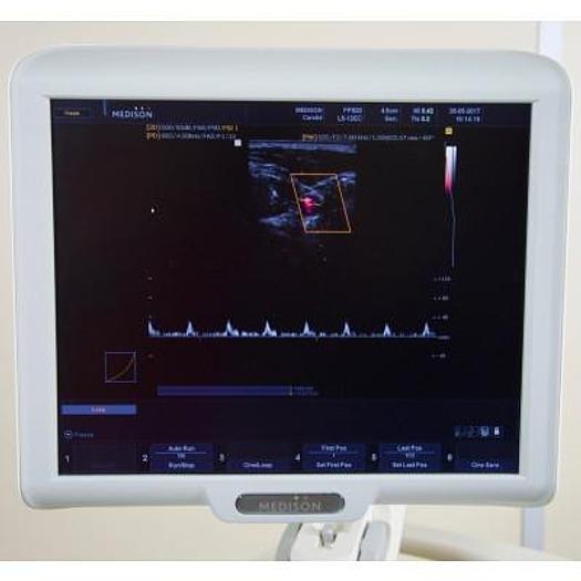 D'occasion ECHOGRAPHE  "RADIO+CARDIO"  MEDISON SONOACE X8 COULEUR DOPPLER 4 SONDES