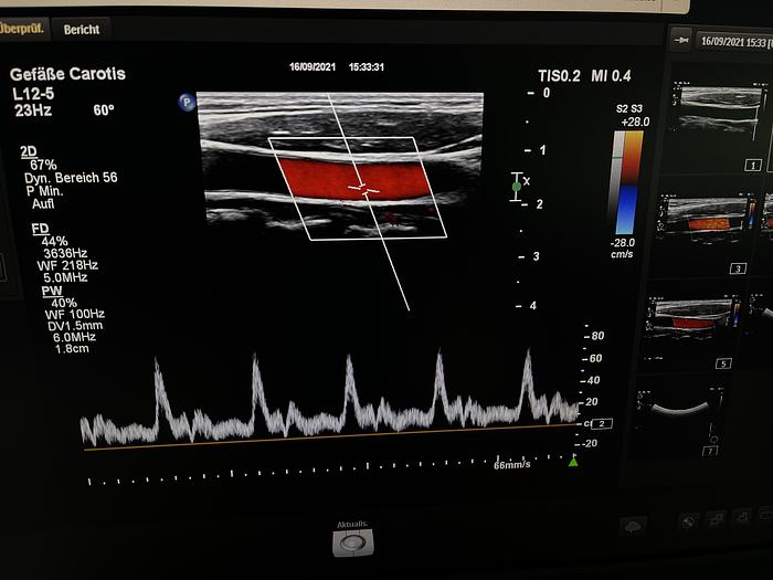 Gebraucht Philips EPIQ 5C Ultraschallsystem mit Sony Drucker