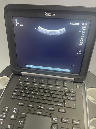 Gebraucht Sonosite Edge Ultraschallgerät inkl. 2 Sonden und Sony UP-D897 Drucker