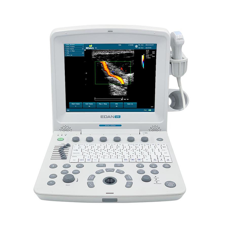 Used Edan U50 Prime Edition Ultrasound Machine