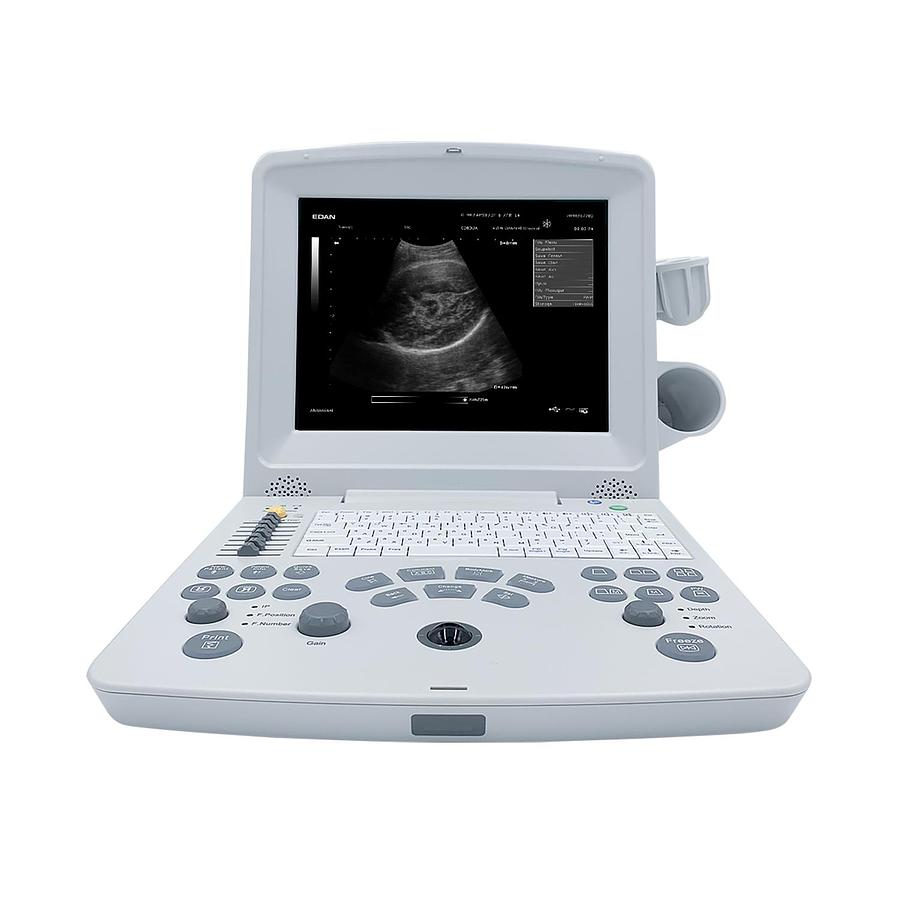 Used Edan DUS60 Ultrasound