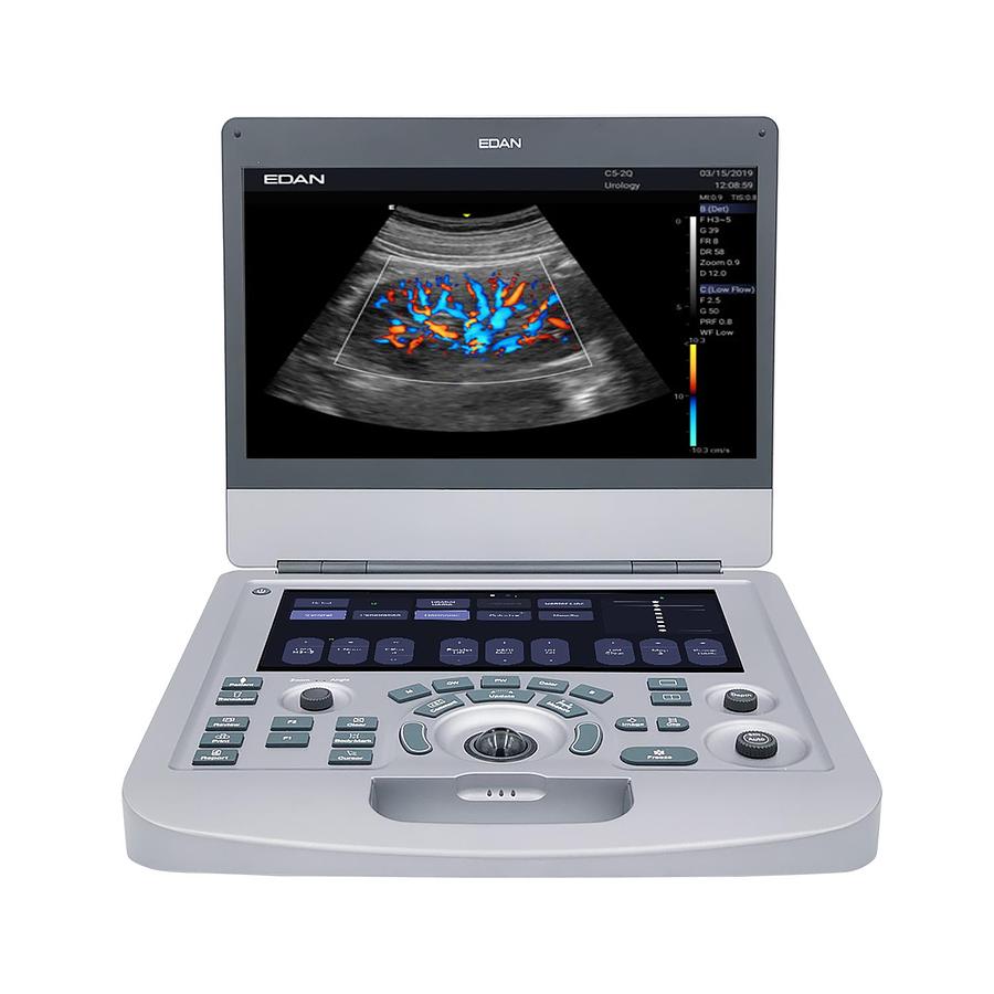 Used Edan AX2/AX3 Ultrasound