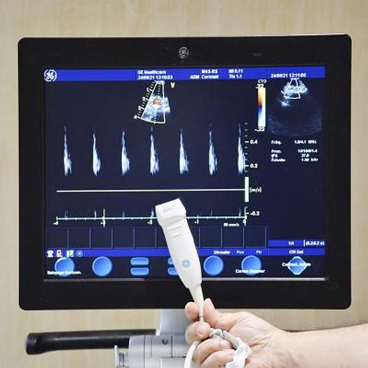 D'occasion ECHOCARDIOGRAPHE GENERAL ELECTRIC VIVID S6 AVEC 4 SONDES