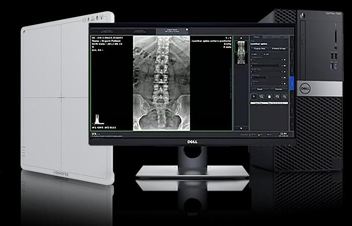 Vieworks VIVIX-S 1417N Wireless Flat Panel Detector