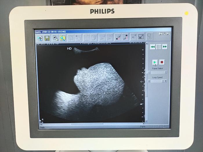 Gebraucht Philips HD7 XE Diagnostik Ultraschallsystem mit konvex Sonde, Drucker und DVD Brenner