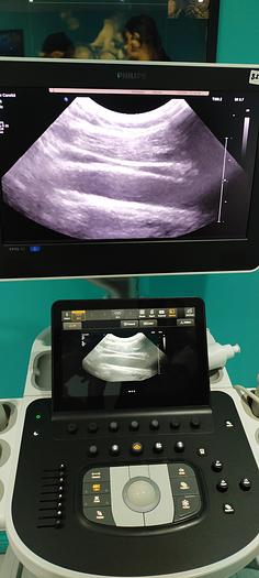 Gebraucht Philips C8-5 Mikrokonvex Ultraschallsonde
