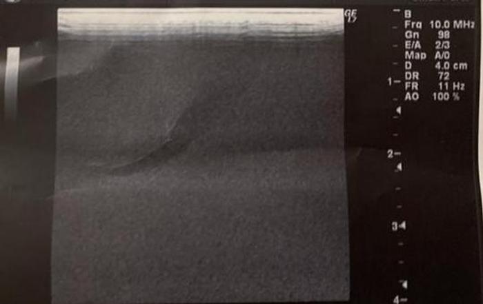 Gebraucht 10 L GE Healthcare probe